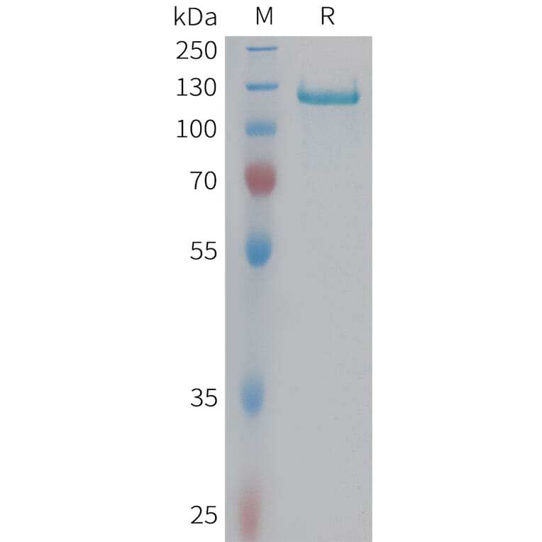 SDS-PAGE - Recombinant Human C6 Protein (6xHis Tag) (A324941) - Antibodies.com