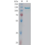 SDS-PAGE - Recombinant Human C6 Protein (6xHis Tag) (A324941) - Antibodies.com