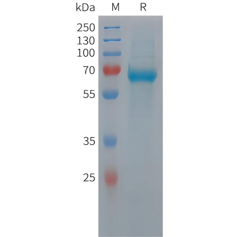 SDS-PAGE - Recombinant Human C9 Protein (6xHis Tag) (A324942) - Antibodies.com
