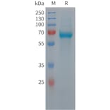 SDS-PAGE - Recombinant Human C9 Protein (6xHis Tag) (A324942) - Antibodies.com