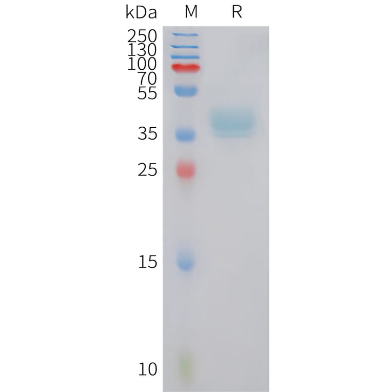 SDS-PAGE - Recombinant Human CCXCR1/XCR1 Protein (Fc Tag) (A324943) - Antibodies.com