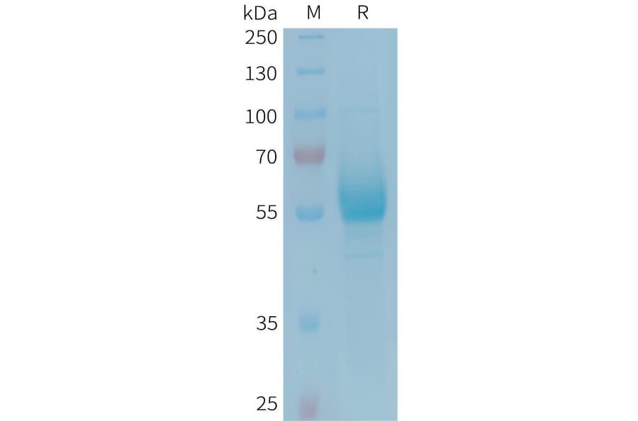 SDS-PAGE - Recombinant Human CD161 Protein (Fc Tag) (A324944) - Antibodies.com