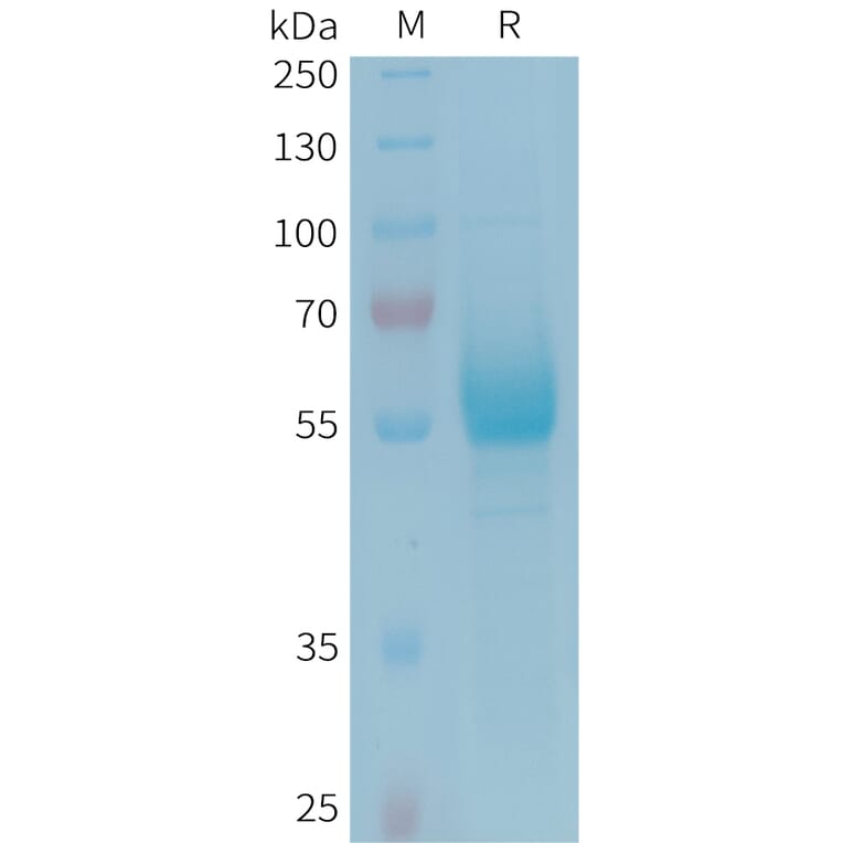 SDS-PAGE - Recombinant Human CD161 Protein (Fc Tag) (A324944) - Antibodies.com