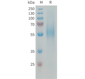 SDS-PAGE - Recombinant Human CD204 Protein (6xHis Tag) (A324945) - Antibodies.com