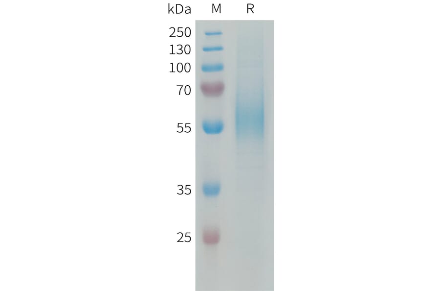 SDS-PAGE - Recombinant Human CD204 Protein (6xHis Tag) (A324945) - Antibodies.com