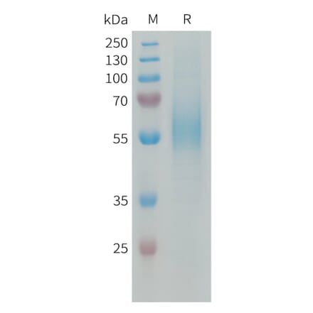 SDS-PAGE - Recombinant Human CD204 Protein (6xHis Tag) (A324945) - Antibodies.com