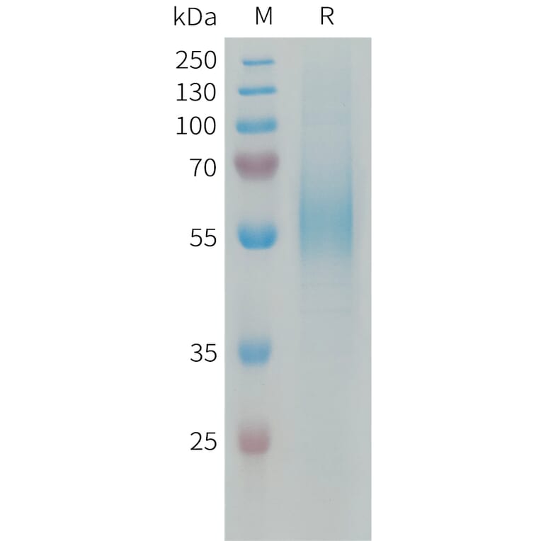 SDS-PAGE - Recombinant Human CD204 Protein (6xHis Tag) (A324945) - Antibodies.com