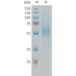 SDS-PAGE - Recombinant Human CD204 Protein (6xHis Tag) (A324945) - Antibodies.com