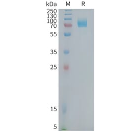 SDS-PAGE - Recombinant Human CD22 Protein (Fc Tag) (A324946) - Antibodies.com