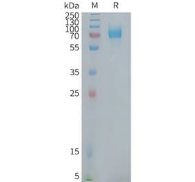 SDS-PAGE - Recombinant Human CD22 Protein (Fc Tag) (A324947) - Antibodies.com