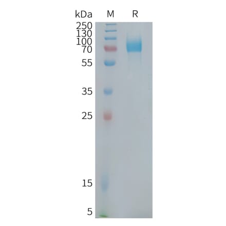 SDS-PAGE - Recombinant Human CD22 Protein (Fc Tag) (A324947) - Antibodies.com