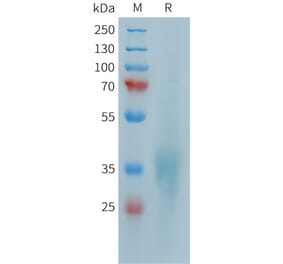 SDS-PAGE - Recombinant Human CD28 Protein (10xHis Tag) (A324948) - Antibodies.com