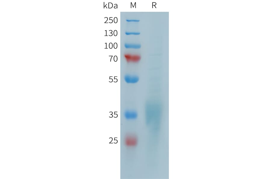 SDS-PAGE - Recombinant Human CD28 Protein (10xHis Tag) (A324948) - Antibodies.com
