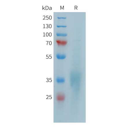 SDS-PAGE - Recombinant Human CD28 Protein (10xHis Tag) (A324948) - Antibodies.com