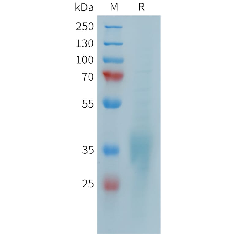 SDS-PAGE - Recombinant Human CD28 Protein (10xHis Tag) (A324948) - Antibodies.com