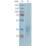 SDS-PAGE - Recombinant Human CD28 Protein (10xHis Tag) (A324948) - Antibodies.com