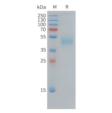 SDS-PAGE - Recombinant Human CD33 Protein (10xHis Tag) (A324951) - Antibodies.com