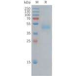 SDS-PAGE - Recombinant Human CD33 Protein (10xHis Tag) (A324951) - Antibodies.com