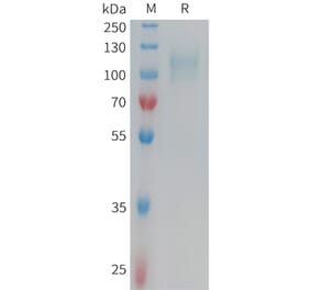 SDS-PAGE - Recombinant Human CD62E Protein (6xHis Tag) (A324952) - Antibodies.com