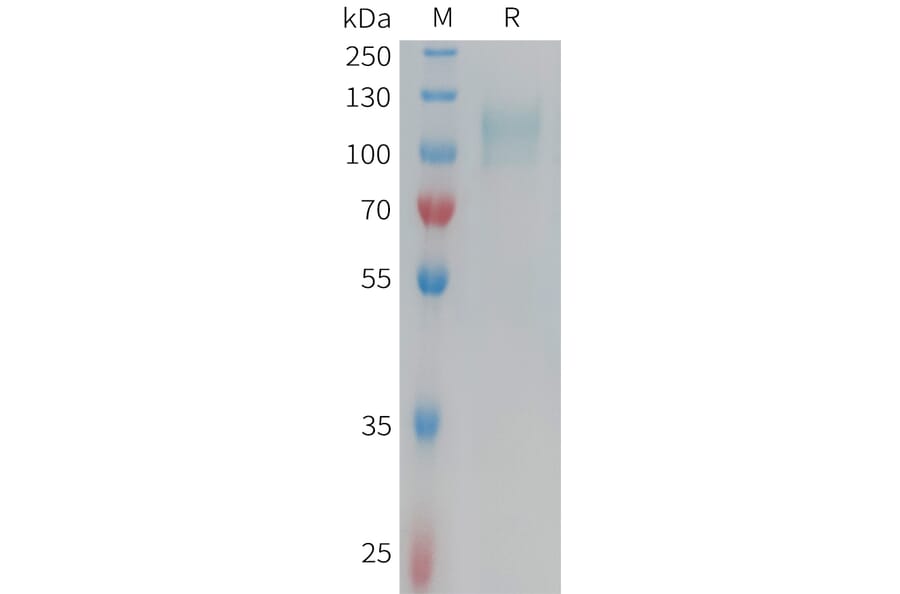 SDS-PAGE - Recombinant Human CD62E Protein (6xHis Tag) (A324952) - Antibodies.com