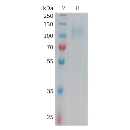 SDS-PAGE - Recombinant Human CD62E Protein (6xHis Tag) (A324952) - Antibodies.com
