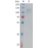 SDS-PAGE - Recombinant Human CD62E Protein (6xHis Tag) (A324952) - Antibodies.com