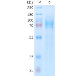 SDS-PAGE - Recombinant Human CD97 Protein (6xHis Tag) (A324953) - Antibodies.com