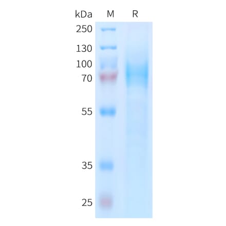 SDS-PAGE - Recombinant Human CD97 Protein (6xHis Tag) (A324953) - Antibodies.com