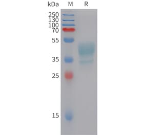 SDS-PAGE - Recombinant Human CMKLR1 Protein (Fc Tag) (A324955) - Antibodies.com