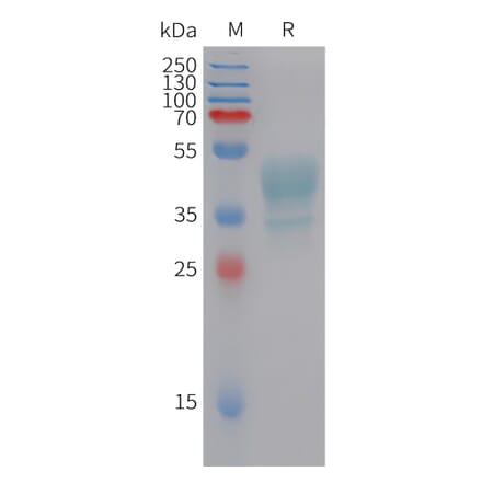 SDS-PAGE - Recombinant Human CMKLR1 Protein (Fc Tag) (A324955) - Antibodies.com