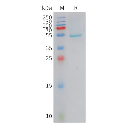 SDS-PAGE - Recombinant Human CRCP Protein (Fc Tag) (A324956) - Antibodies.com