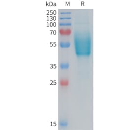 SDS-PAGE - Recombinant Human CRLR Protein (Fc Tag) (A324957) - Antibodies.com