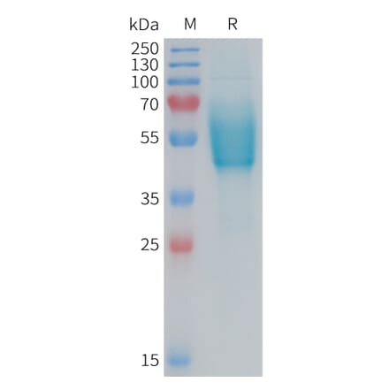 SDS-PAGE - Recombinant Human CRLR Protein (Fc Tag) (A324957) - Antibodies.com