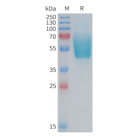 SDS-PAGE - Recombinant Human CRLR Protein (Fc Tag) (A324958) - Antibodies.com