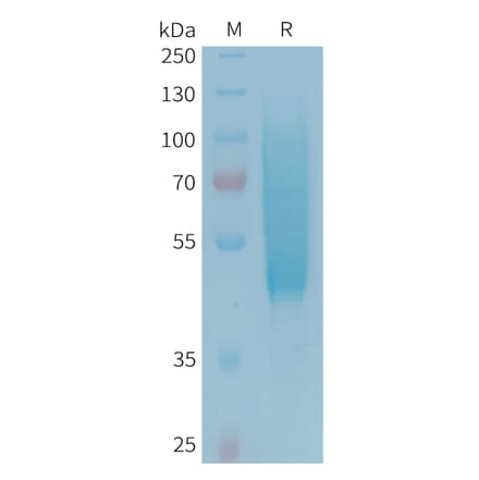 SDS-PAGE - Recombinant Human CX3CL1 Protein (6xHis Tag) (A324961) - Antibodies.com
