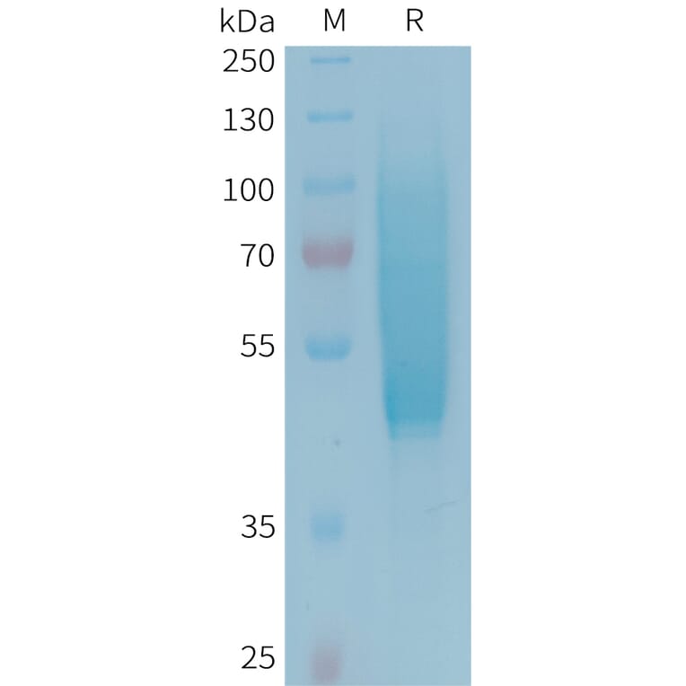 SDS-PAGE - Recombinant Human CX3CL1 Protein (6xHis Tag) (A324961) - Antibodies.com
