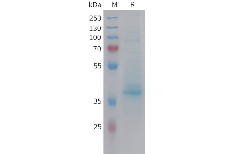 SDS-PAGE - Recombinant Human CXCL14 Protein (Fc Tag) (A324962) - Antibodies.com