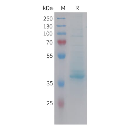 SDS-PAGE - Recombinant Human CXCL14 Protein (Fc Tag) (A324962) - Antibodies.com