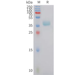 SDS-PAGE - Recombinant Human CXCR6 Protein (Fc Tag) (A324963) - Antibodies.com
