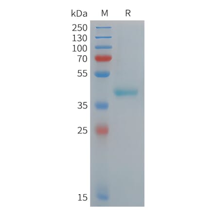 SDS-PAGE - Recombinant Human DC-SIGN Protein (6xHis Tag) (A324964) - Antibodies.com