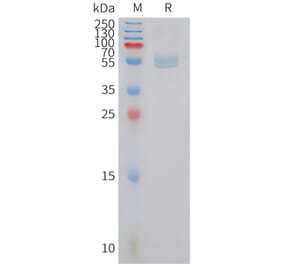 SDS-PAGE - Recombinant Human Dectin-1 Protein (Fc Tag) (A324965) - Antibodies.com