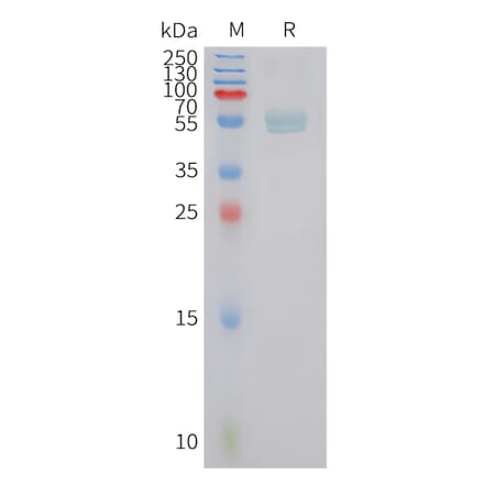 SDS-PAGE - Recombinant Human Dectin-1 Protein (Fc Tag) (A324965) - Antibodies.com