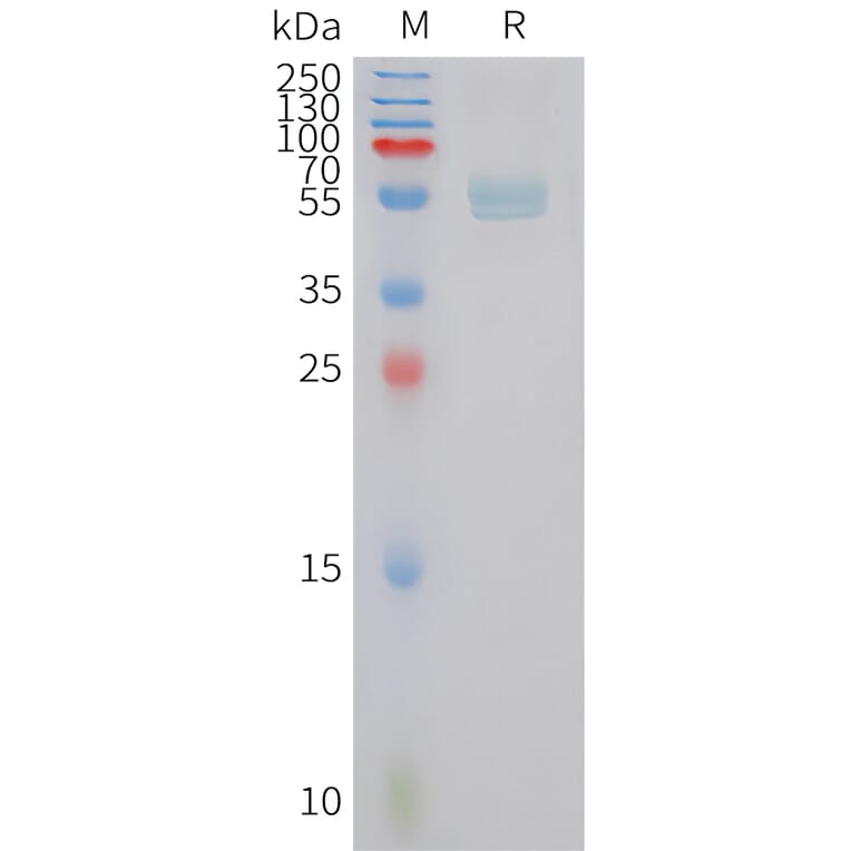SDS-PAGE - Recombinant Human Dectin-1 Protein (Fc Tag) (A324965) - Antibodies.com