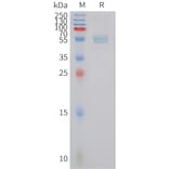 SDS-PAGE - Recombinant Human Dectin-1 Protein (Fc Tag) (A324965) - Antibodies.com