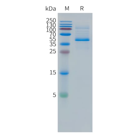 SDS-PAGE - Recombinant Human DLL3 Protein (Fc Tag) (A324966) - Antibodies.com