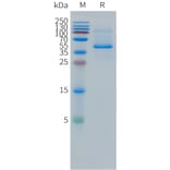 SDS-PAGE - Recombinant Human DLL3 Protein (Fc Tag) (A324966) - Antibodies.com