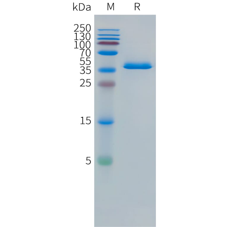 SDS-PAGE - Recombinant Human DLL3 Protein (Fc Tag) (A324967) - Antibodies.com