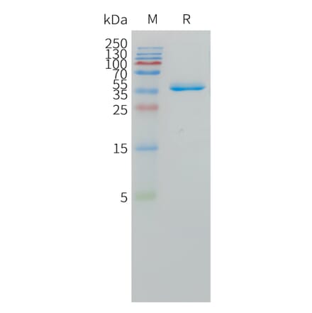 SDS-PAGE - Recombinant Human DLL3 Protein (Fc Tag) (A324969) - Antibodies.com
