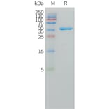 SDS-PAGE - Recombinant Human DLL3 Protein (Fc Tag) (A324969) - Antibodies.com