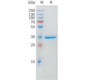 SDS-PAGE - Recombinant Human DLL3 Protein (Fc Tag) (A324970) - Antibodies.com